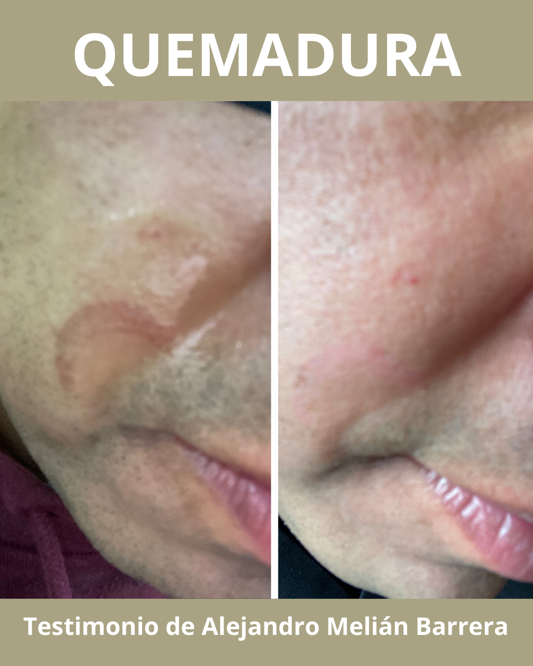 Crema Reparadora y Protectora Multipropósito Pack Familiar 3 UNIDADES | ENVÍO GRATIS 🚚